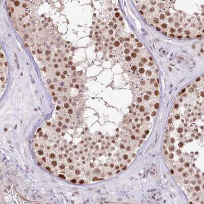 Immunohistochemistry-Paraffin: NSUN2 Antibody [NBP1-82189]