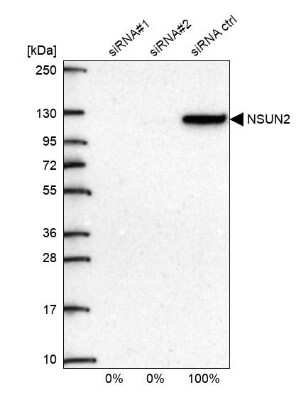 Western Blot: NSUN2 Antibody [NBP1-82189]