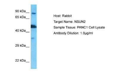 Western Blot: NSUN2 Antibody [NBP2-85404]