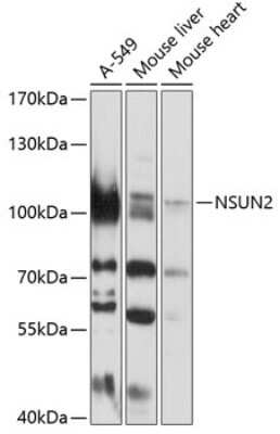 Western Blot: NSUN2 AntibodyBSA Free [NBP2-94855]