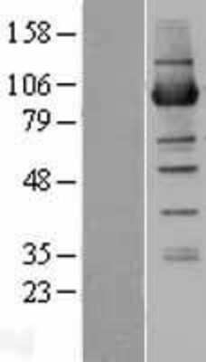 Western Blot: NSUN2 Overexpression Lysate [NBL1-13814]