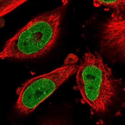 Immunocytochemistry/ Immunofluorescence: NSUN3 Antibody [NBP2-58292]