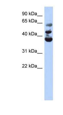 Western Blot: NSUN3 Antibody [NBP1-55169]