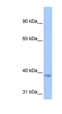 Western Blot: NSUN3 Antibody [NBP1-55170]