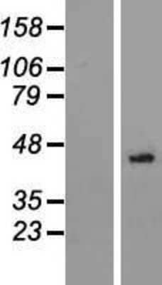 Western Blot: NSUN3 Overexpression Lysate [NBL1-13815]