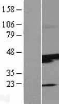 Western Blot: SUNC1 Overexpression Lysate [NBP2-11218]