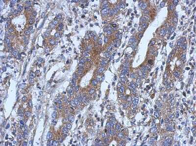 Immunohistochemistry-Paraffin: NSUN4 Antibody [NBP2-19594]