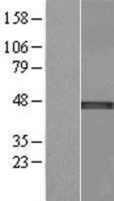 Western Blot: NSUN4 Overexpression Lysate [NBL1-13816]