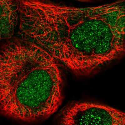 Immunocytochemistry/ Immunofluorescence: NSUN5 Antibody [NBP2-56795]