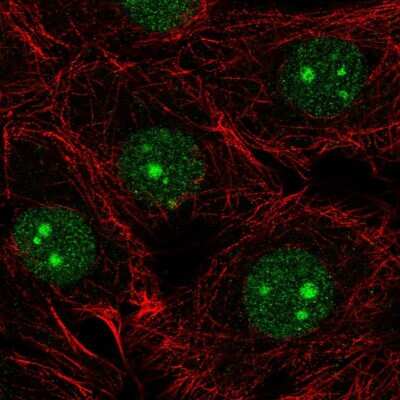 Immunocytochemistry/ Immunofluorescence: NSUN5 Antibody [NBP2-58249]