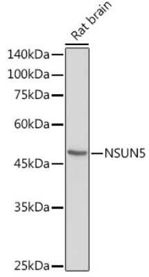 Western Blot: NSUN5 AntibodyAzide and BSA Free [NBP3-16628]