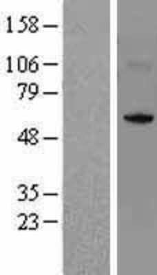 Western Blot: NSUN5 Overexpression Lysate [NBL1-13817]