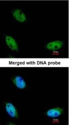 Immunocytochemistry/ Immunofluorescence: NSUN6 Antibody [NBP1-32531]