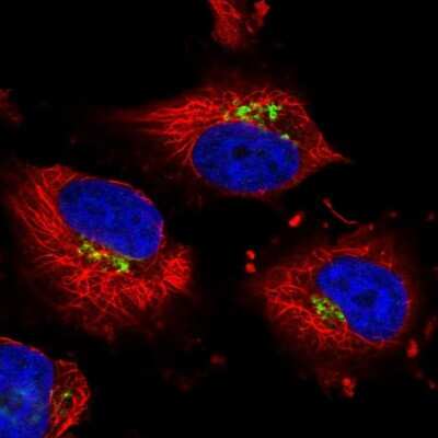 Immunocytochemistry/ Immunofluorescence: NSUN6 Antibody [NBP1-92202]