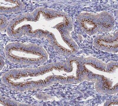 Immunohistochemistry-Paraffin: NSUN6 Antibody [NBP1-92202]