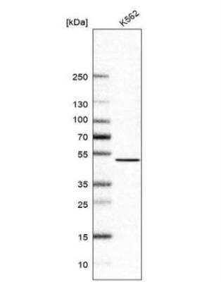 Western Blot: NSUN6 Antibody [NBP1-92202]