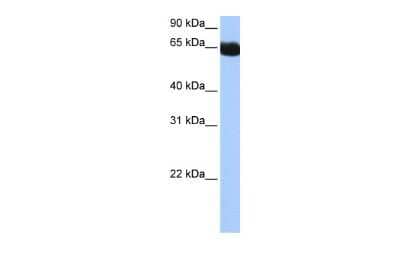 Western Blot: NSUN6 Antibody [NBP2-85405]