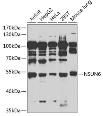 Western Blot: NSUN6 AntibodyBSA Free [NBP2-94132]