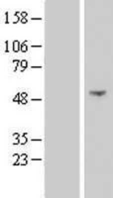 Western Blot: NSUN7 Overexpression Lysate [NBP2-06298]