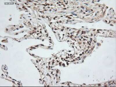 Immunohistochemistry: NT-3 Antibody (OTI5A2) - Azide and BSA Free [NBP2-72972]