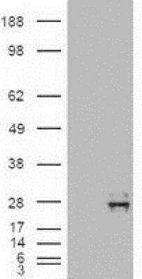 Western Blot: NT-4 Antibody (OTI2E8) [NBP1-47897]
