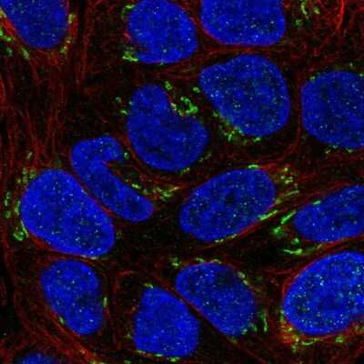 Immunocytochemistry/ Immunofluorescence: NT-4 Antibody [NBP2-58130]