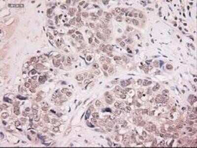 Immunohistochemistry: NT-4 Antibody (OTI2E8) - Azide and BSA Free [NBP2-73072]