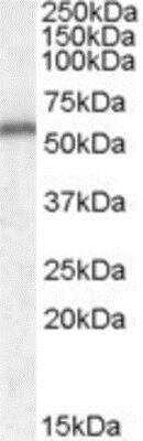 Western Blot: NT-4 Antibody [NBP1-20951]