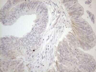 Immunohistochemistry: NT-proBNP Antibody (OTI11G4) - Azide and BSA Free [NBP2-71213]