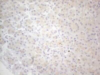 Immunohistochemistry: NT-proBNP Antibody (OTI11G4) - Azide and BSA Free [NBP2-71213]