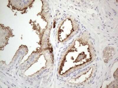 Immunohistochemistry: NT-proBNP Antibody (OTI11G4) - Azide and BSA Free [NBP2-71213]