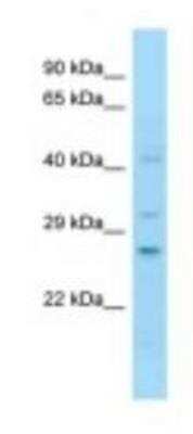 Western Blot: NT2NL Antibody [NBP1-98582]