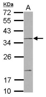 Western Blot: NT2NL Antibody [NBP2-19595]