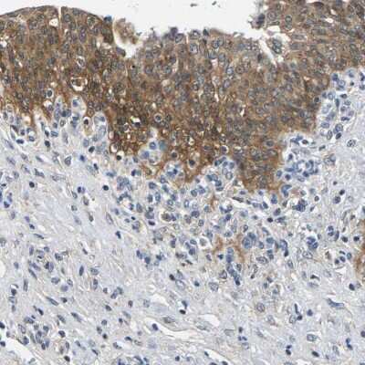 Immunohistochemistry-Paraffin: NT5C Antibody [NBP1-84564]