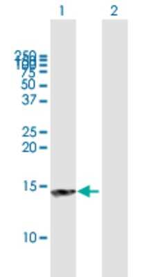 Western Blot: NT5C Antibody [H00030833-B01P]