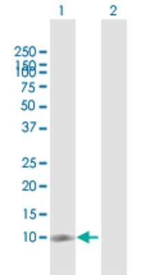 Western Blot: NT5C Antibody [H00030833-D01P]