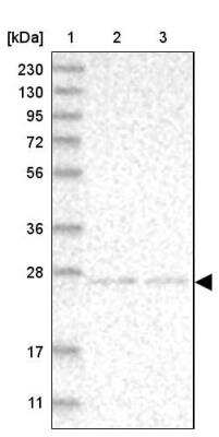 Western Blot: NT5C Antibody [NBP1-84564]