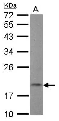 Western Blot: NT5C Antibody [NBP2-19596]