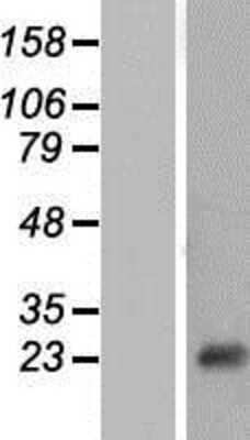 Western Blot: NT5C Overexpression Lysate [NBP2-07309]