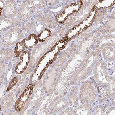 Immunohistochemistry: NT5C1A Antibody [NBP2-48604]