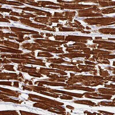 Immunohistochemistry-Paraffin: NT5C1A Antibody [NBP2-49121]