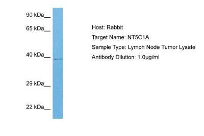 Western Blot: NT5C1A Antibody [NBP2-85408]