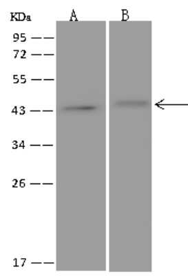 Western Blot: NT5C1A Antibody [NBP3-06431]