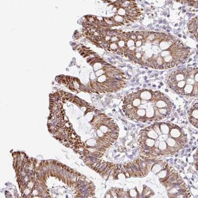 Immunohistochemistry-Paraffin: NT5C1B Antibody [NBP2-33797]