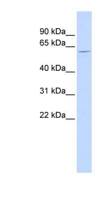 Western Blot: NT5C1B Antibody [NBP1-56911]