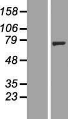 Western Blot: NT5C1B Overexpression Lysate [NBP2-05901]