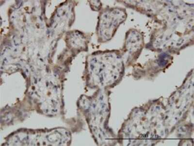 Immunohistochemistry-Paraffin: NT5C2 Antibody (3C1) [H00022978-M02]