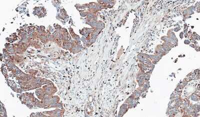 Immunohistochemistry-Paraffin: NT5C2 Antibody [NBP1-31404]