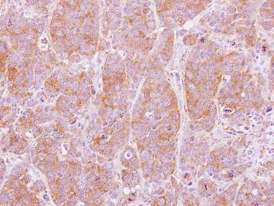 Immunohistochemistry-Paraffin: NT5C2 Antibody [NBP2-19597]