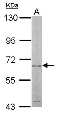 Western Blot: NT5C2 Antibody [NBP1-31404]
